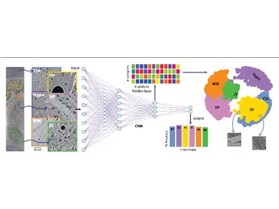 UCL - Comp0188 深度表示与学习 考试&作业&论文辅导